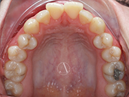 Before - Ali Orthodontics Dental