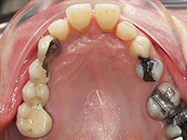 Before - Ali Orthodontics Dental