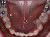 Before - Ali Orthodontics Dental