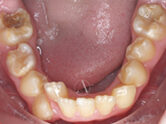 Before - Ali Orthodontics Dental