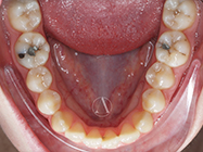 Before - Ali Orthodontics Dental