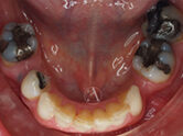 Before - Ali Orthodontics Dental