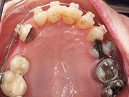 After - Ali Orthodontics Dental