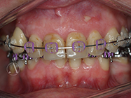After - Ali Orthodontics Dental