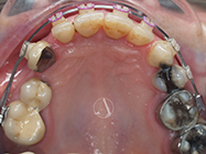 After - Ali Orthodontics Dental