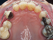 After - Ali Orthodontics Dental