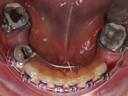 After - Ali Orthodontics Dental