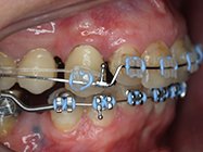 After - Ali Orthodontics Dental