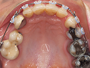 After - Ali Orthodontics Dental