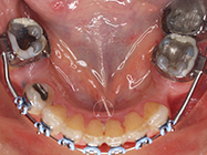 After - Ali Orthodontics Dental