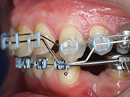 After - Ali Orthodontics Dental