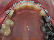 After - Ali Orthodontics Dental