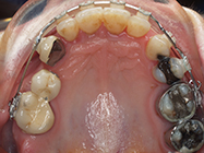 After - Ali Orthodontics Dental