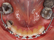 After - Ali Orthodontics Dental