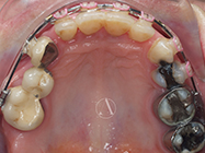 After - Ali Orthodontics Dental