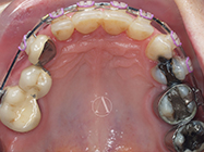 After - Ali Orthodontics Dental