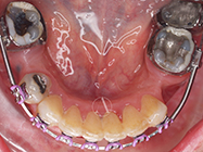 After - Ali Orthodontics Dental