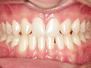 After - Ali Orthodontics Dental