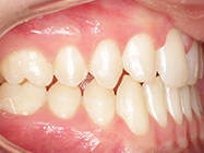 After - Ali Orthodontics Dental