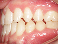 After - Ali Orthodontics Dental