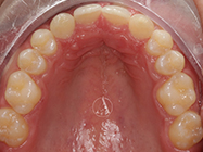 After - Ali Orthodontics Dental