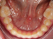 After - Ali Orthodontics Dental