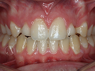 After - Ali Orthodontics Dental