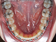 After - Ali Orthodontics Dental