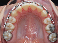 After - Ali Orthodontics Dental