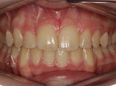 After - Ali Orthodontics Dental