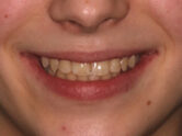 After - Ali Orthodontics Dental