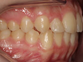 After - Ali Orthodontics Dental