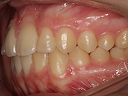 After - Ali Orthodontics Dental