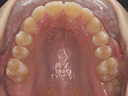 After - Ali Orthodontics Dental