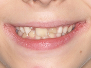Before - Ali Orthodontics Dental