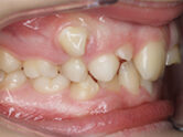 Before - Ali Orthodontics Dental