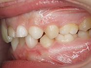 Before - Ali Orthodontics Dental