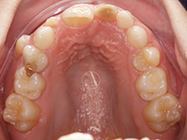 Before - Ali Orthodontics Dental