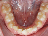 Before - Ali Orthodontics Dental