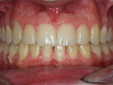 After - Ali Orthodontics Dental