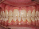 After - Ali Orthodontics Dental