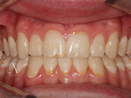 After - Ali Orthodontics Dental