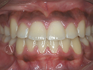 After - Ali Orthodontics Dental