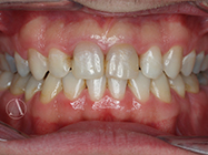 After - Ali Orthodontics Dental