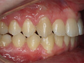 After - Ali Orthodontics Dental