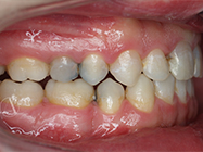After - Ali Orthodontics Dental