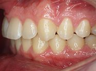 After - Ali Orthodontics Dental