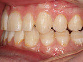 After - Ali Orthodontics Dental