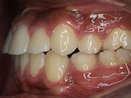 After - Ali Orthodontics Dental