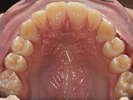 After - Ali Orthodontics Dental